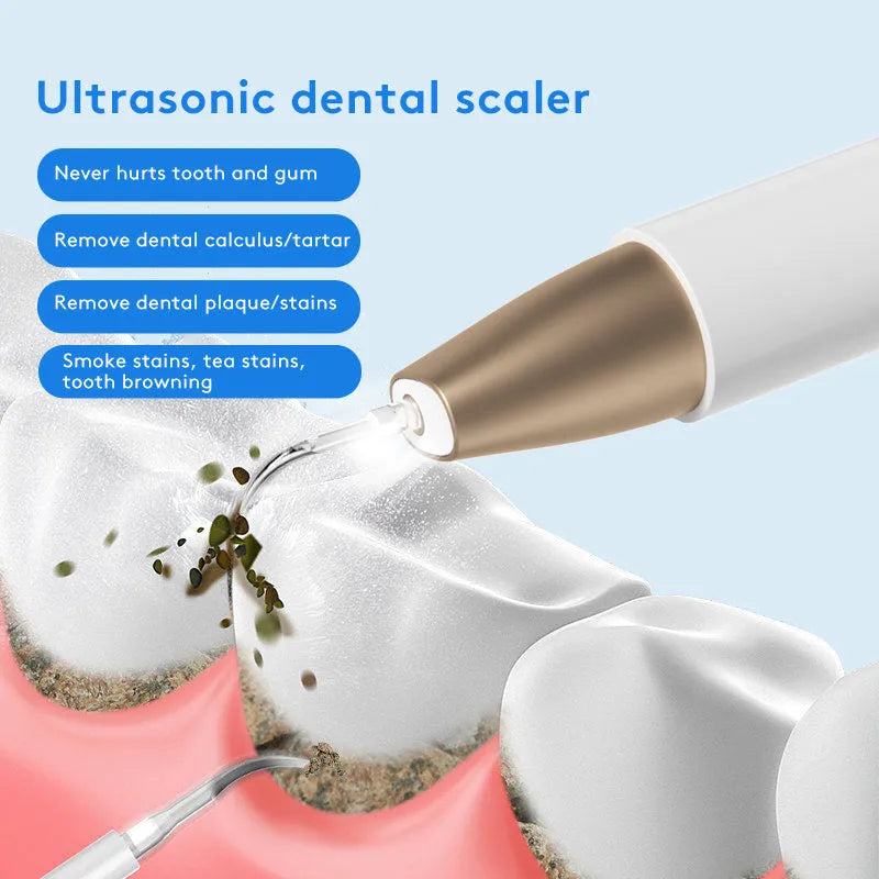 Gold-coloured ultrasonic tooth cleaning device for removing tartar and stains.