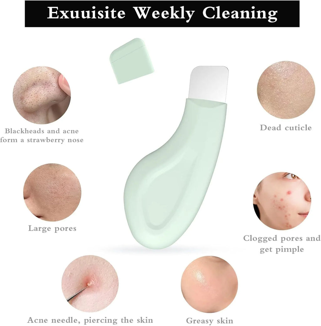 Green stainless steel facial pore scraper tool with a non-slip handle for blackhead removal.