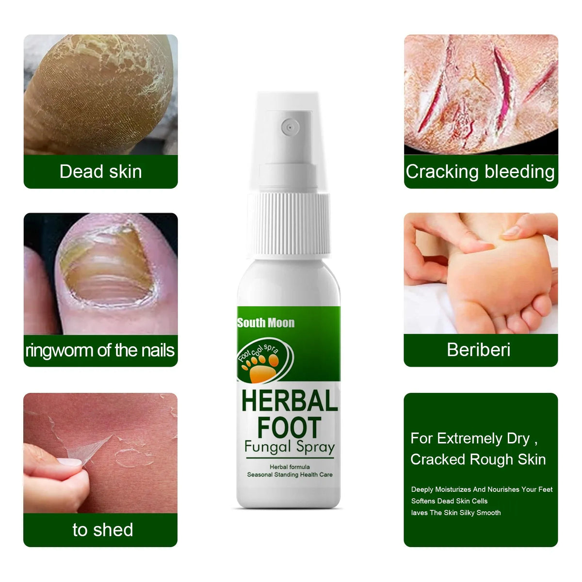 30ml foot skin care spray bottle with moisturising and hydrating formula for foot treatment