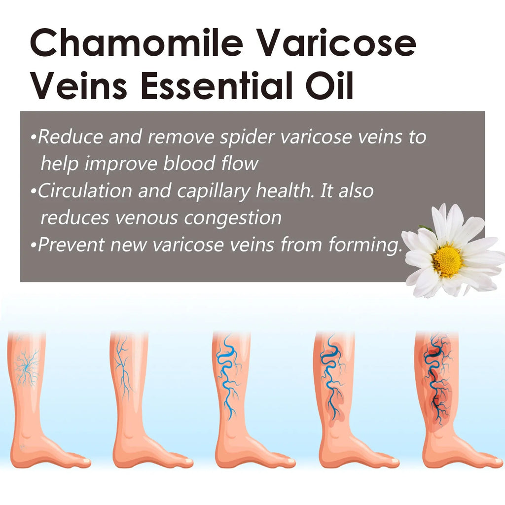 10ml chamomile leg essential oil bottle for massage and skin care