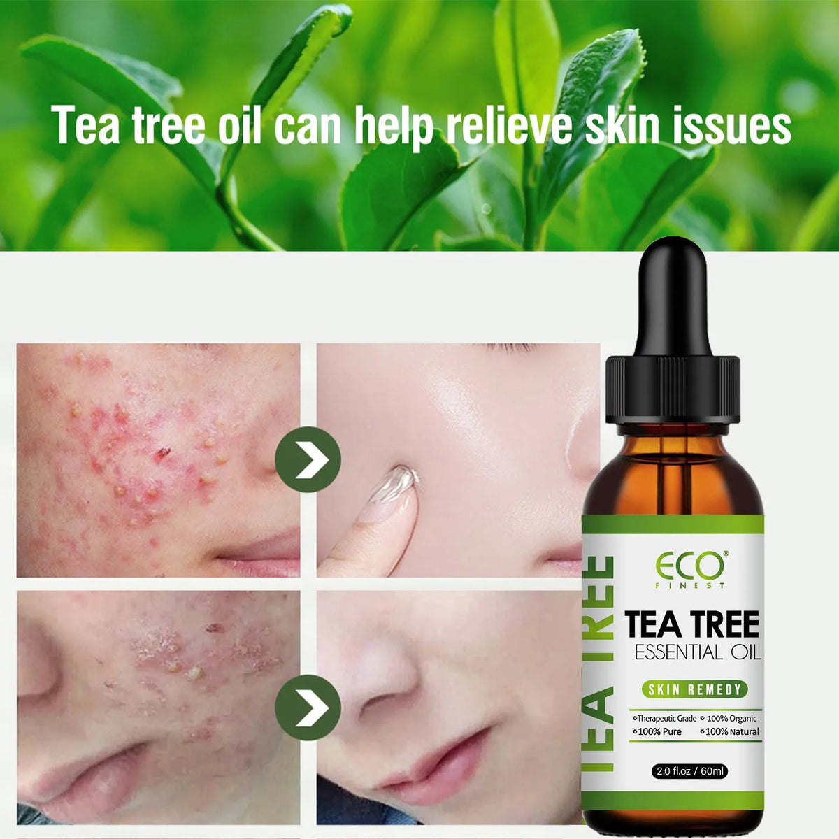 60ml bottle of pure tea tree essential oil for facial skin treatment and massage