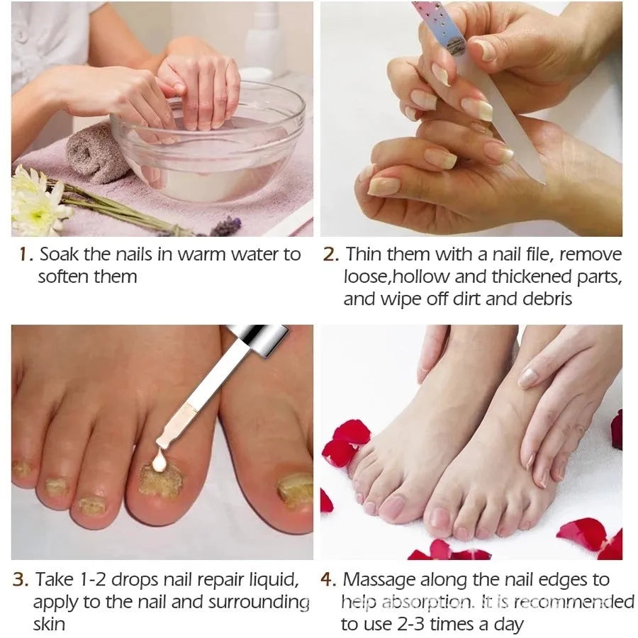 Jiagou 10ml antimicrobial foot treatment liquid bottle for nail whitening