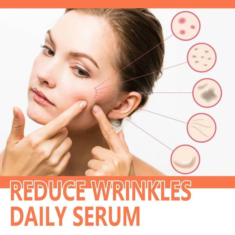 30ml rose essential oil bottle for facial wrinkles and brightening
