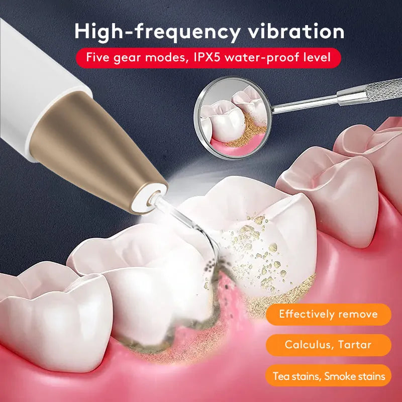 Gold-coloured ultrasonic tooth cleaning device for removing tartar and stains.
