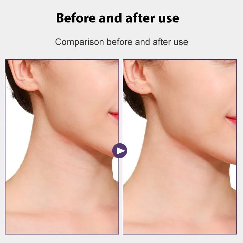 Skin tone neck firming adhesive tape with lifting strips and patches