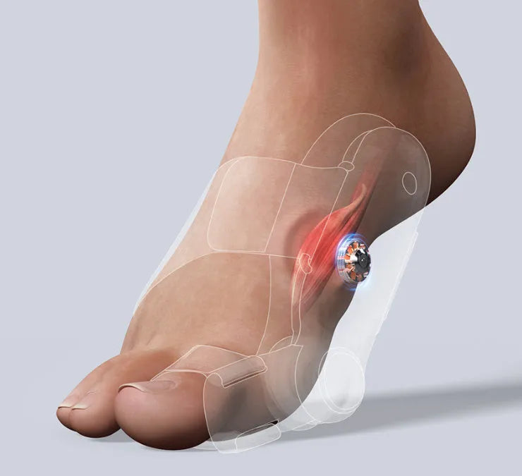 White plastic electric hallux valgus toe separator with Type-C charging port.