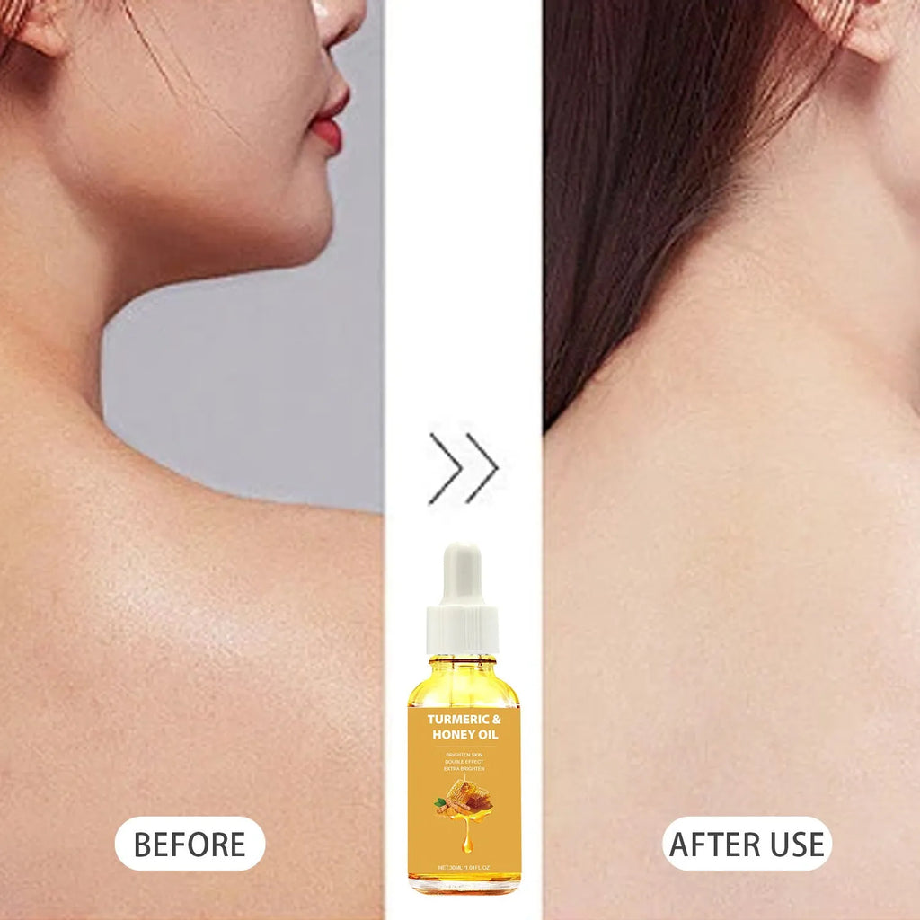 30ml turmeric honey essential oil bottle with neutral packaging for facial beauty
