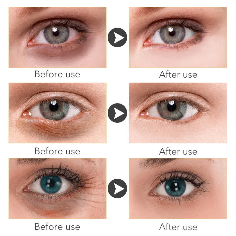 30ml eye cream container for women's skincare and beauty routines