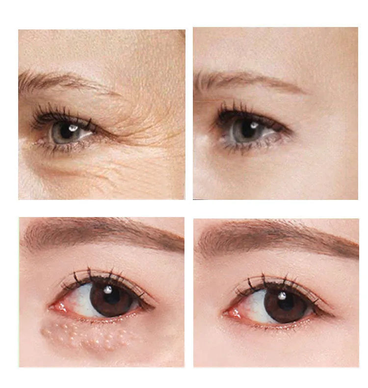 30ml eye cream container for women's skincare and beauty routines