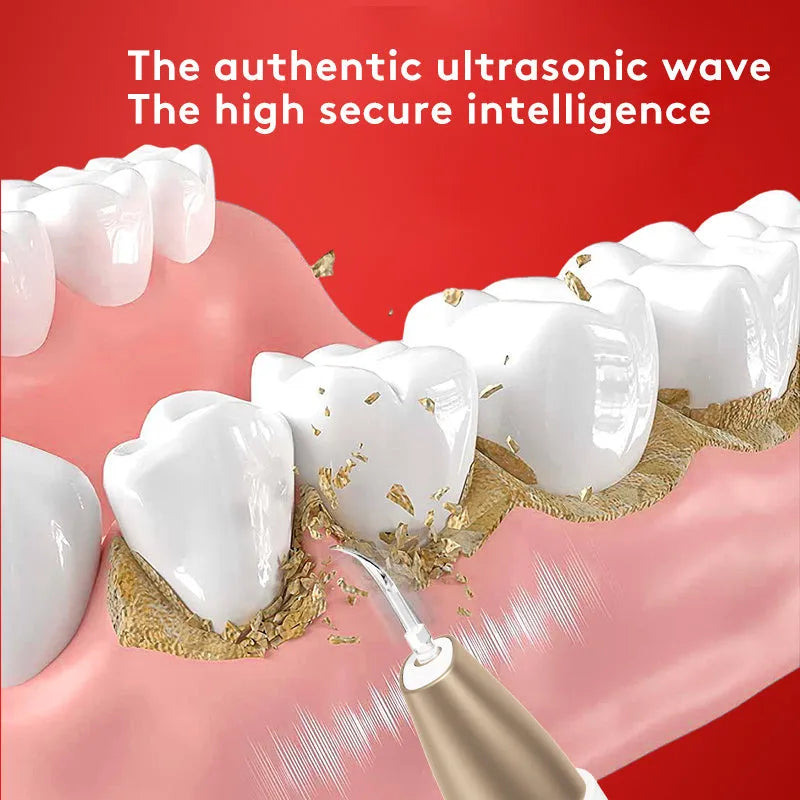 Gold-coloured ultrasonic tooth cleaning device for removing tartar and stains.